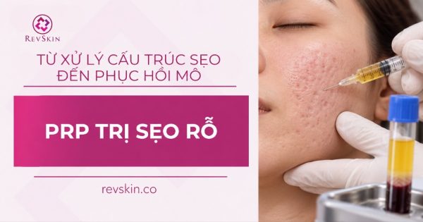 thumb prp điều trị seo rỗ